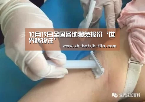世界杯买球网站